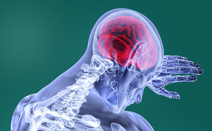 Types of Paralysis: Monoplegia, Hemiplegia, Paraplegia, and Quadriplegia